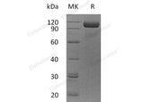 Recombinant Human EGFR/ErbB1 Protein (aa 25-30Gly&aa298-645, Fc Tag)(Active)