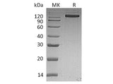 Recombinant Human EGFR/ErbB1 Protein (aa 25-645, Fc Tag)(Active)