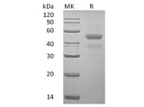 Recombinant Human ERP44 Protein (His Tag)