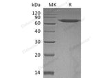 Recombinant Human ERO1A/ERO1L Protein (His Tag)