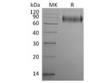 Recombinant Human E-Selectin/SELE Protein (His Tag)