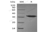 Recombinant Human Esterase D/ESD Protein (His Tag)