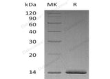 Recombinant Human Estrogen Receptor α/ER alpha Protein (His Tag)