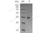 Recombinant Human SELENOI/EPT1 Protein (GST Tag)