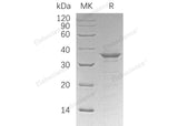 Recombinant Human ETS1/EWSR2 Protein (His Tag)