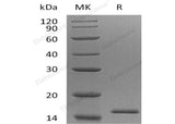 Recombinant Human EIF1B Protein (His Tag)