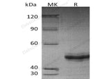 Recombinant Human EIF5A2 Protein (His Tag)