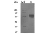 Recombinant Human FAS/TNFRSF6 Protein (Fc Tag)