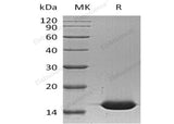 Recombinant Human L-FABP/FABP1 Protein (His Tag)