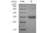 Recombinant Human CD32a/FCGR2A Protein (His Tag)