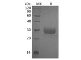 Recombinant Human CD32a/FCGR2A Protein (H131, His Tag)