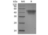 Recombinant Human CD16a/FCGR3A Protein (His Tag)(Active)