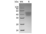 Recombinant Human CD16a/FCGR3A Protein (His Tag,Val176Phe) 