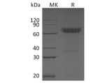 Recombinant Human CD16b/FCGR3B Protein (Fc & His Tag)