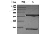 Recombinant Human FcRn & B2M Heterodimer Protein (His Tag)