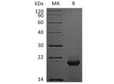 Recombinant Human FTH Protein