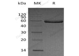 Recombinant Human Fetuin-B/FETUB Protein (His Tag)