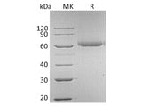 Recombinant Human FGFR5/FGFRL1 Protein (His Tag)(Active)