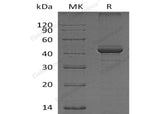 Recombinant Human FIBP Protein