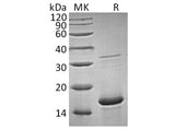 Recombinant Human FGF-1/FGFa Protein