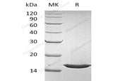 Recombinant Human FGF-1/FGFa Protein (Active)