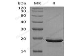 Recombinant Human FGF-12/FGF12 Protein (Active)