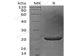 Recombinant Human FGF-17 Protein (Active)