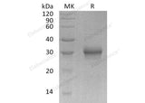 Recombinant Human FGF-17 Protein (His Tag)(Active)