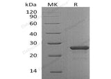 Recombinant Human FGF-19/FGF9 Protein (His Tag)(Active)