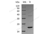 Recombinant Human FGF-2/FGFb Protein (aa 134-288)(Active)