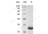 Recombinant Human FGF-2/FGFb Protein (aa 143-288)(Active)