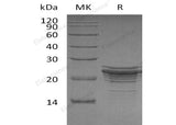 Recombinant Human FGF21 Protein (His Tag)