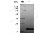 Recombinant Human FGF-4/FGF4 Protein (Active)