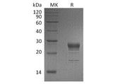 Recombinant Human FGF-7/KGF Protein (His Tag)(Active)