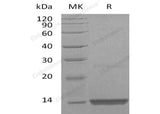 Recombinant Human FGF-9/FGF9 Protein (Active)