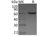 Recombinant Human Fibronectin/FN Protein (Active)