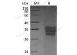 Recombinant Human FLT3LG/Flt3 Ligand Protein (His Tag)