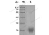 Recombinant Human FSH Protein (Flag & His Tag)