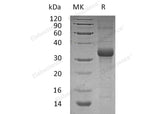 Recombinant Human FSTL1 Protein (Active)