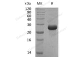 Recombinant Human FSTL1 Protein (His Tag, E. coli)(Active)