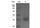 Recombinant Human Follitropin Subunit β/FSHB Protein (His Tag)