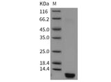 Recombinant Human Insulin Protein (Active)