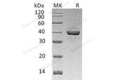 Recombinant Human ALDOC Protein (His Tag)