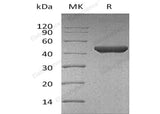 Recombinant Human Fumarase/FH Protein