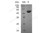 Recombinant Human Fumarylacetoacetase/FAH Protein (His Tag)