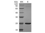 Recombinant Human GABARAPL1 Protein (His Tag)