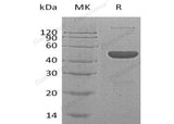 Recombinant Human GABA Protein (His & FcTag)