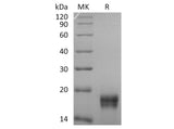 Recombinant Human GADD45β/GADD45B Protein (His Tag)