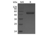 Recombinant Human Galectin 9/LGALS9 Protein (His Tag)(Active)