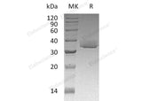 Recombinant Human Galectin-3/LGALS3 Protein (His Tag)(Active)